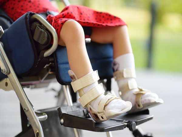 Disabled girl sitting in wheelchair. On her legs orthosis. Child cerebral palsy. Treatment and rehabilitation of CP. Inclusion.